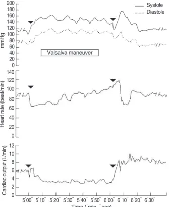Fig. 1. A representative case of the hemodynamics on Valsalva Maneuver.