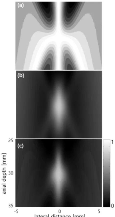 Fig. 7. Images obtained using (a) weighted DAS and  (b) weighted MVB, both with a 40 dB log compression.