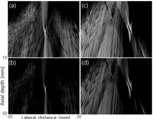 Fig. 15. B-mode images of (a) weighted single bubble  collapse using DAS, (b) weighted single bubble collapse  using  MVB,  (c)  weighted  two  bubble  collapse  using  DAS, and (d) weighted two bubble collapse using MVB.
