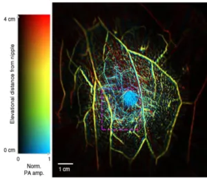 Fig. 3. Photoacoustic imaging result of breast micro- micro-calcifications. [16]   Reproduced  from  J