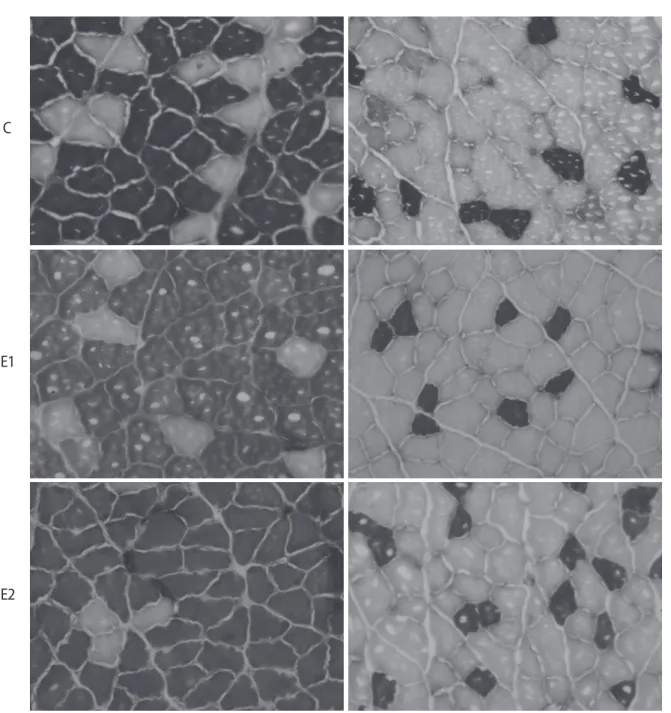 Figure 1. Cross-sections of soleus and plantaris muscles in rats in the C (first line), E1 (second line), and E2 (third line) groups
