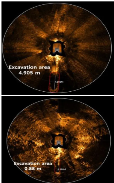 Fig. 16. Rocky &amp; pebble seabed image of around-view  sonar (excavation area).