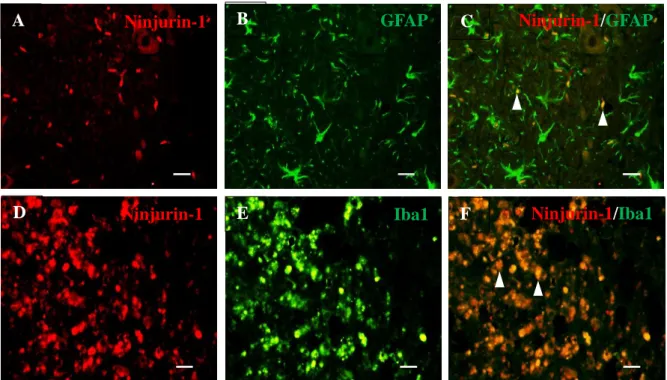 Figure 5. Double immunofluorescence staining of (A, D) Ninjurin-1, (B) GFAP, and (E) Iba-1 in  spinal cord tissues following clip compression injury