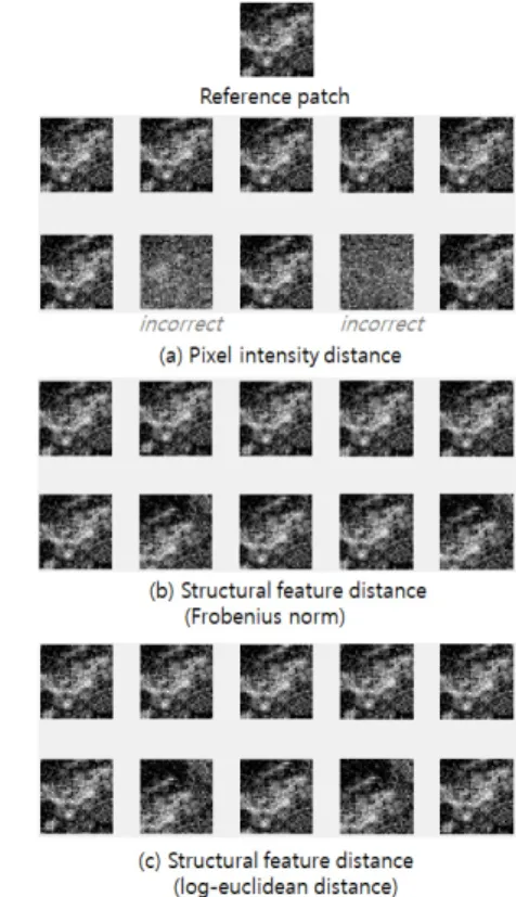Fig. 3. Similar patches searched by (a) pixel intensity  distance  (b)  structural  feature  distance  with  euclidean  distance  (c)  structural  feature  distance  with log-euclidean distance.
