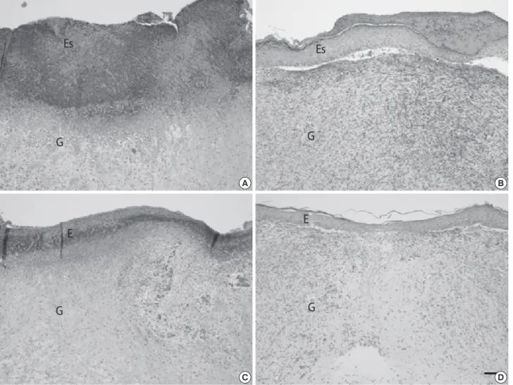 Figure 1. Comparison of the epithelial gap between control and CTL extract-treated rat