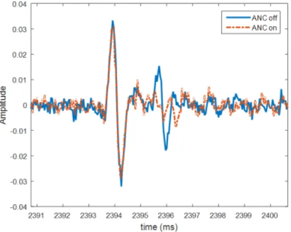 Fig.  9.  Frequency  response  of  the  reflected  burst  before and after the control.