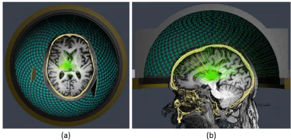 Fig. 3-2 Preview of the developed ray tracing software with patient-specific CT and MRI data