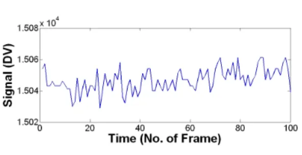 Fig. 8 Temporal signal variation of an arbitrary pixel within a specified region of interest collected for 100 frames