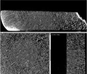 Fig. 2.  Image  of  a  femoral  trabecular  bone  sample  obtained  by  using  micro-CT.