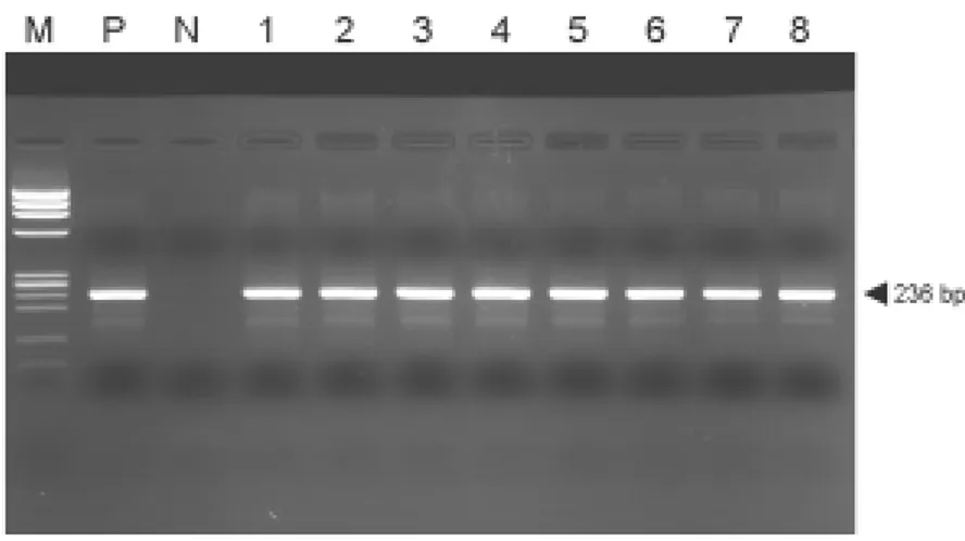 Figure 5. Amplified 5'-UTR region of HCV RNAs forHCV genotyping.  Analysis in this study 5'-UTR region of HCV RNAs were amplified  by RT-PCR from HCV 5'UTR for genotyping