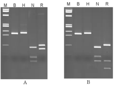 Figure 6. RFLP patterns of HCVs found in Jeju, which were assumed  subtype 1a. 5'-UTR region of HCV RNA was amplified and digested  with four restriction enzymes