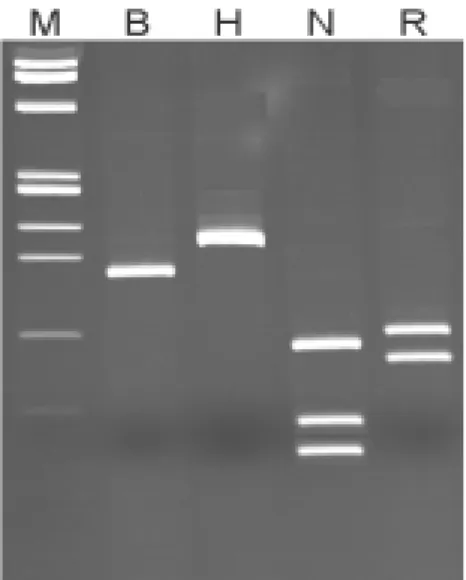Figure  7.  RFLP  patterns    of  the  HCVs  found  in  Jeju,  which  was  assumed  subtype  1b  (JHCV  7)