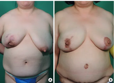 Figure 4. Pre- and postoperative clinical images of Case 2. 