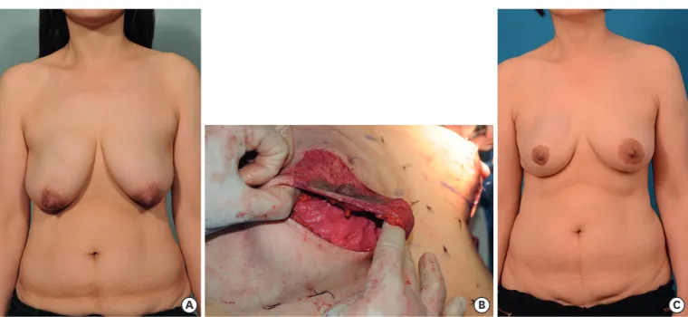 Figure 5. Pre- and postoperative clinical images of Case 3. 