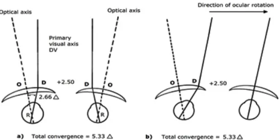 Fig. 5. Plan view of eyes focusing on a distant object. DV distance view; O, optic center; D, distance view point; R, ocular rotation center.