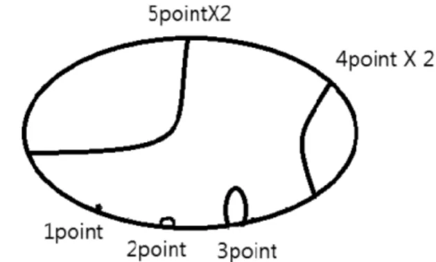 Fig. 2. Strain  o n eyeglasses shown by strainer.