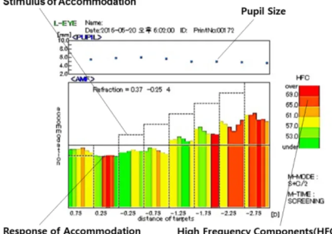 Table 2. Accommodative responses and High-frequency component (HFC) of accommodation to accommodation stimuli  Stimulus of  Accommodation Response of Accommodation High frequency  components (HFC) SD P-value