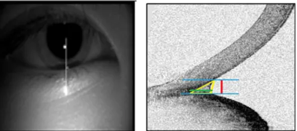 Fig. 1. Images of the lower tear meniscus and the position of the eye. Left: The white line shows the site of image capture and the scanning direction