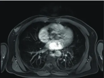 Figure 1. Findings of MRI of the breast. 