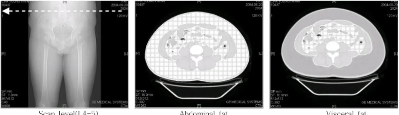 Fig. 1. The Measurement of Abdominal uand Visceral Fat Area