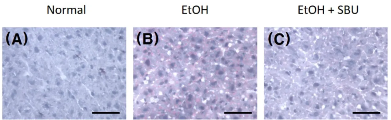 Fig.  3.  Oil  Red  O  staining  of  liver  tissue  from  Normal,  EtOH,  and  EtOH+Silbi-um  (SBU)  groups