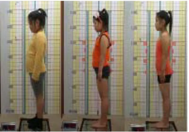 Fig.  2.  Change  of  Body  shape Ⅲ.  고  찰 비만이란  지방세포의  수가  증가하거나  크기가  켜져  피하층과  조직내에  과도한  양의  지방이  축적되어  있 는  상태로  남자의  경우  체지방율이  25%이상,  여자는  30%이상인  경우  혹은  비만도  120%  초과,  BMI지수  25  이상인  경우를  비만이라고  한다