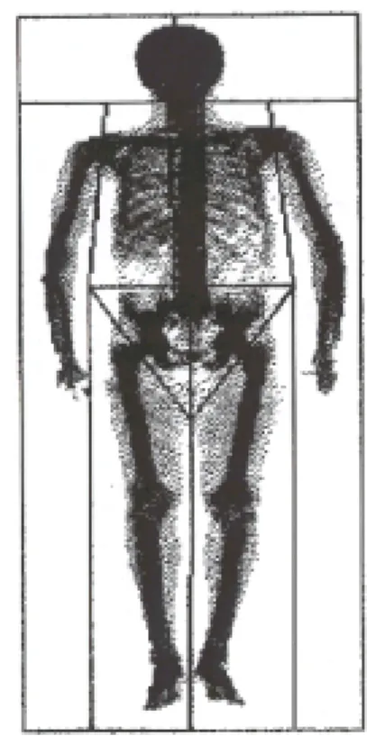 Fig.  3.  DXA  planogram  demonstrating  cut-points  that  determine  arm  and  leg  regions