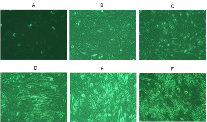 Fig. 4. Morphologic changes of C2C12 cells by differentiation. The images were captured using microscope (×100)