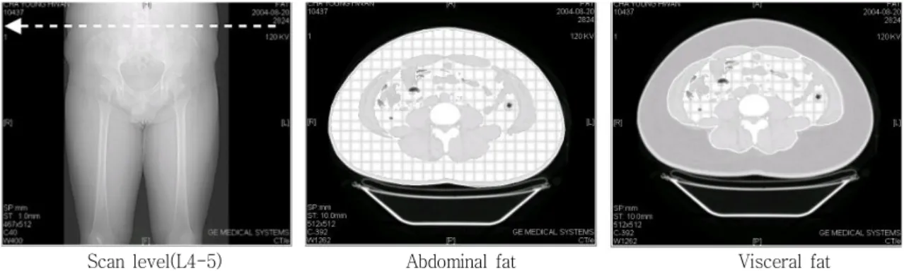 Fig. 1. The Measurement of Abdominal and Visceral Fat Area