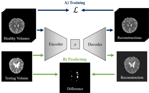 Fig. 2. Concepts of unsupervised lesion detection based on the 3D autoencoder. A) Training: We learn the model  from healthy people's brain MRI, B) Testing: We reconstruct the patient's healthy brain to healthy brain with  trained model, and extract lesion