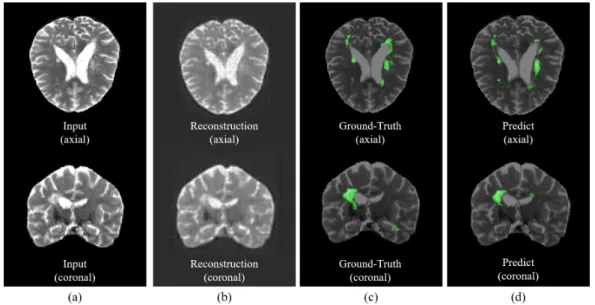Fig. 3. Demonstration of the proposed 3D autoencoder-based method of lesion detection