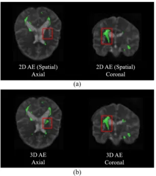Table 1. Quantitative comparison of lesion detection between 2D, 3D autoencoder-based methods using 25 MS data- data-sets (mean±std).