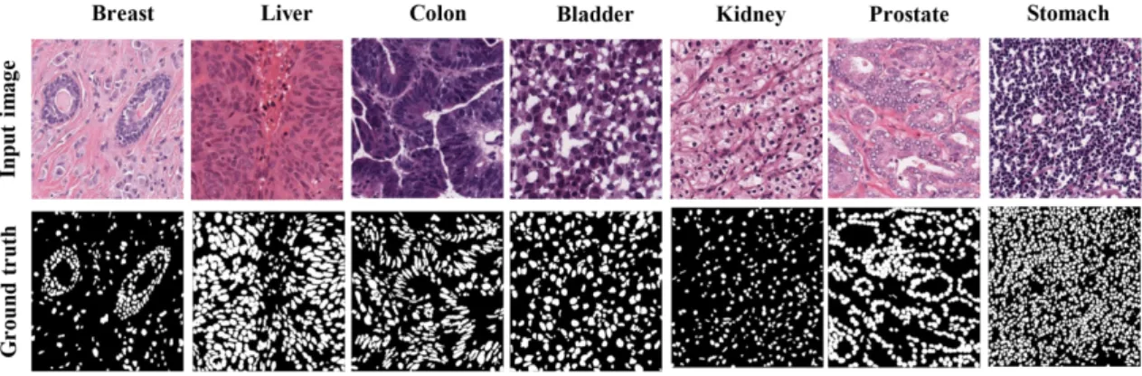 Fig. 1. Some sample images from the MonuSeg dataset.