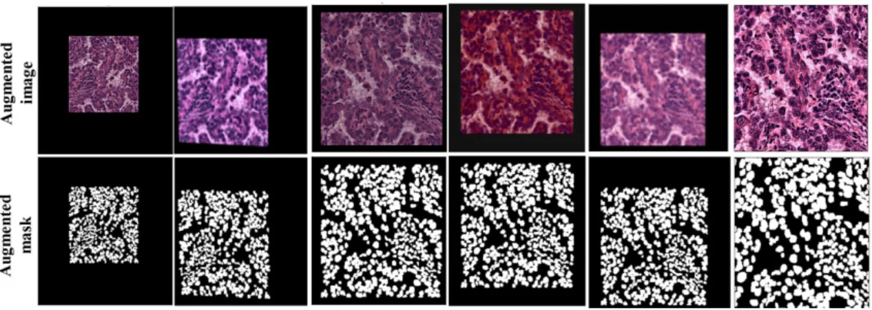Fig. 4. Some sample of augmented images after applied Albumentations library.