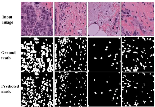 Fig. 6. Qualitative output results of Unet++ with EfficientNet-B1 as the backbone on the TNBC dataset.