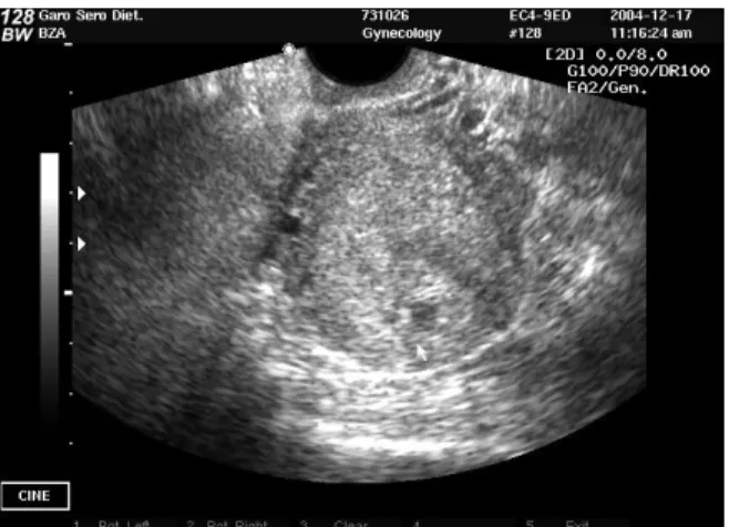 Fig. 3. G-sac
