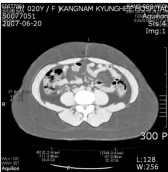 Fig  6.  The  CT  Image  of  Abdominal  and  Visceral  Fat  at  2007.07.03