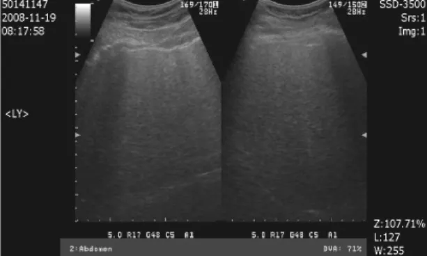 Fig.  5.  The  Changes  of  AST,  ALT Fig.  3.  The  Sonography  of  NAFLD  at  2008.11.19