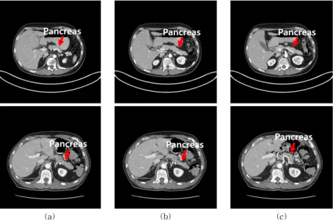 Fig. 1. Example Images of NIH Pancreas-CT Dataset Images. (a) The top part, (b) The middle part, and (c) The  bottom part.