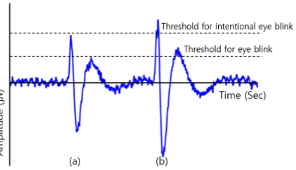 Fig. 1. Threshold for eye blink data.