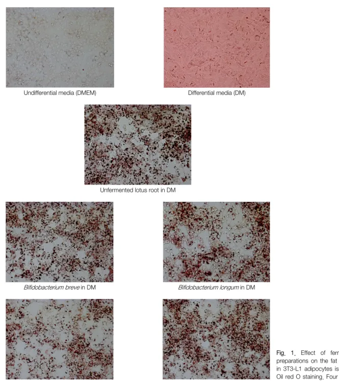 Fig.  1.  Effect  of  fermented  lotus  preparations  on  the  fat  accumulation  in  3T3-L1  adipocytes  is  measured  in  Oil red O  staining