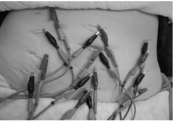Fig.  1.  Determined  Taeumin  using  PSSC Fig.  2.  Electrolipolysis 결과 太陰人으로  판단되어(Fig