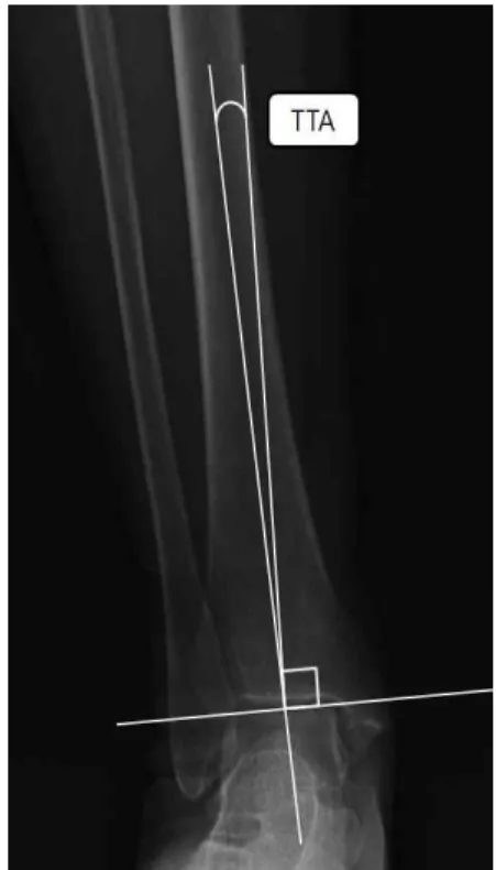 Figure  3.  Lower extremitiy isometric co-contraction (LEIC).
