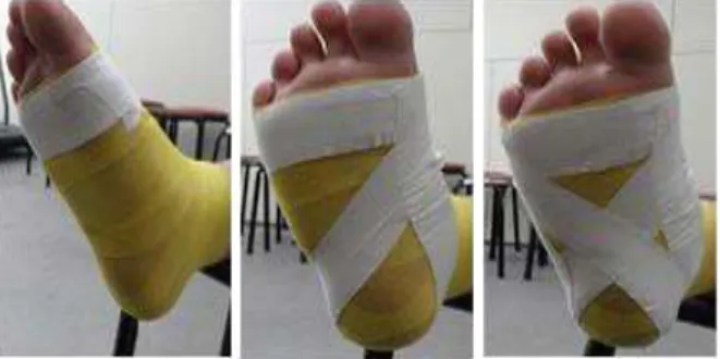 Table  1.  General characteristics of subjects (N=24)Figure  2. Low-Dye taping for excessively