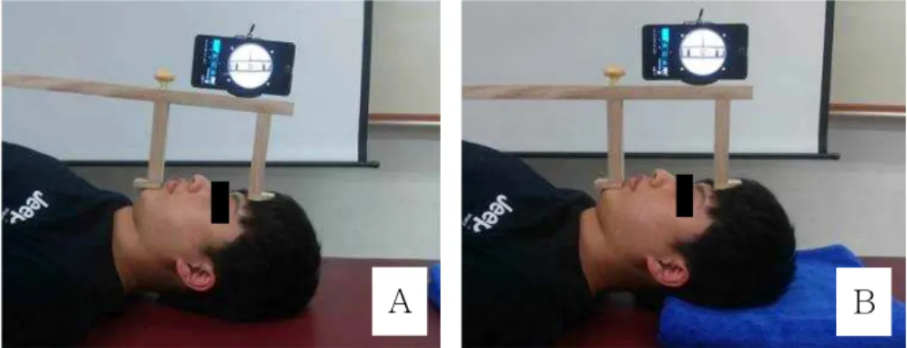 Figure  1.  Two initial positions (A: relaxed head position, B: neutral head position).