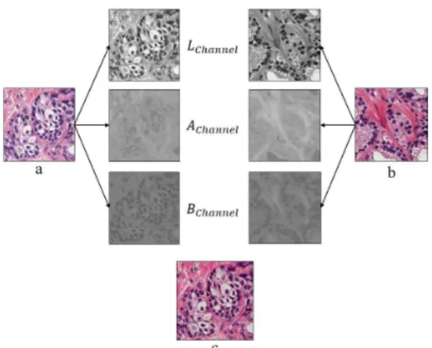 Fig. 2. Stain normalized images of the histological grades.