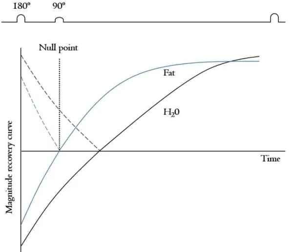 Figure  3.  Magnititude T 1 curve in the short tau inversion recovery (STIR) technique.