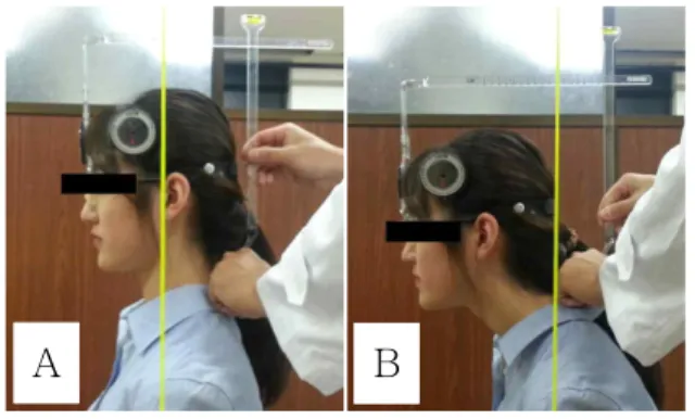 Figure  1.  Measurement of head posture with the cervical range of motion and plumb line (A: neutral head posture, B: forward head posture).