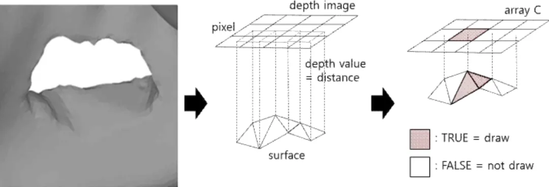 Fig. 10. Selection of polygons in the 3D mesh to make  an implant surface using 2D drawing.