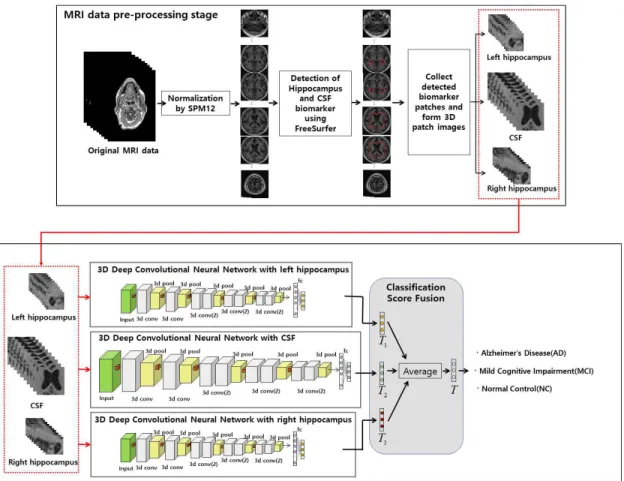 Fig. 2. Overall framwork of our proposed MRI biomarker patch based 3D Deep Convolution Neural Network for  Alzheimer ’s disease diagnosis